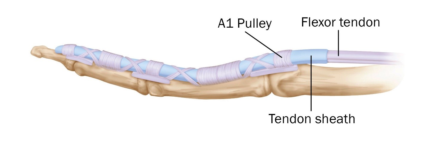 Trigger Finger - Jared Lee, MD