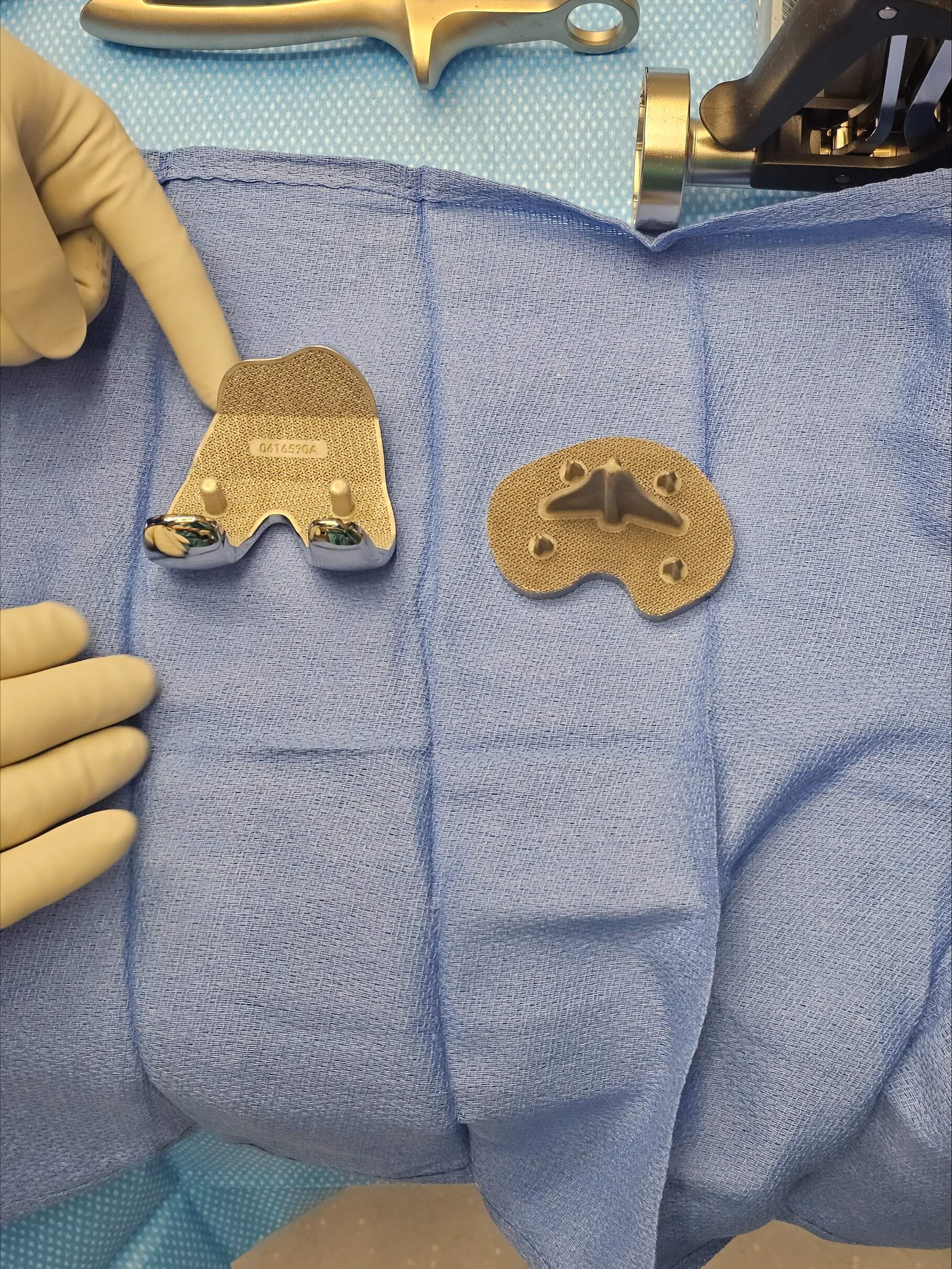 A Game-Changer in Knee Replacement: Dr. Jared Lee Performs One of the First Customized Press-Fit Total Knee Surgeries in the U.S.